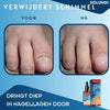 ToePerfect™ - Serum voor gezonde teennagels