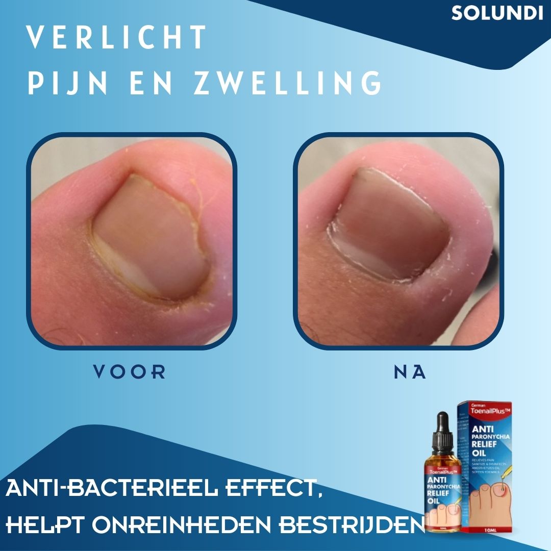 ToePerfect™ - Serum voor gezonde teennagels