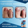 ToePerfect™ - Serum voor gezonde teennagels