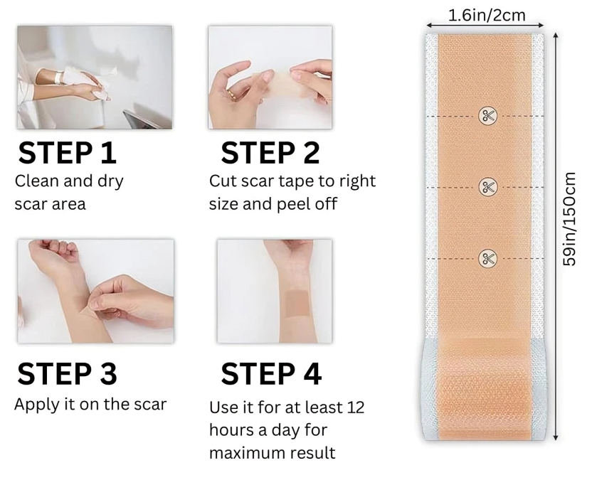 1 + 1 GRATIS VANDAAG | SkinMend™ | Silicone littekenvellen