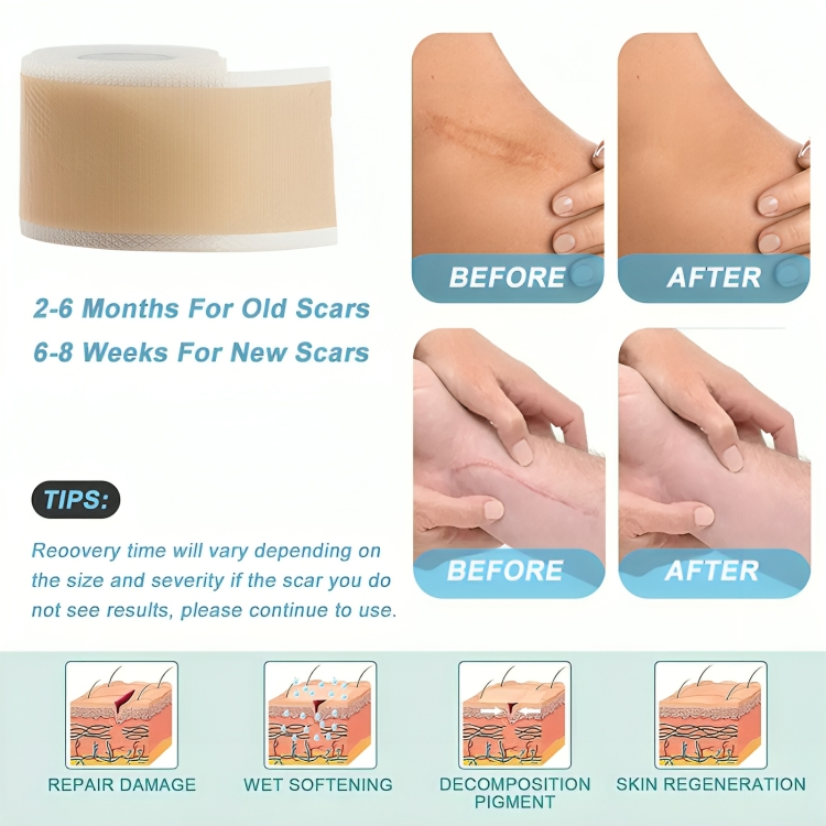 1 + 1 GRATIS VANDAAG | SkinMend™ | Silicone littekenvellen